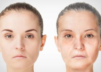 Alami Penuaan Dini ? Kenali Gejala Sindrom Werner