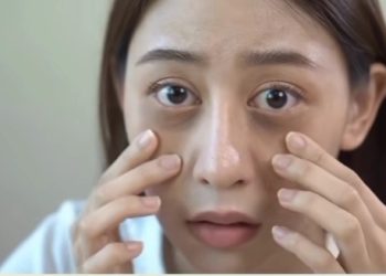 Alami Mata Panda? Berikut Cara Mengatasinya