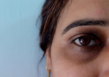 Mudah Mengatasi Mata Panda, No 5 Jangan Dilewatkan