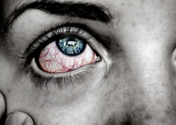 kebanyakan Main Hp Jadi Sakit Mata